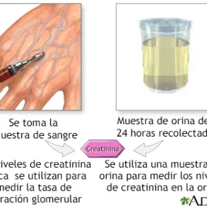 Depuración Creatinina en Orina 24 Horas