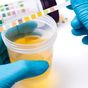 Examen de Orina (Uroanálisis)