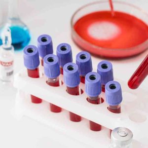 Hematología Completa