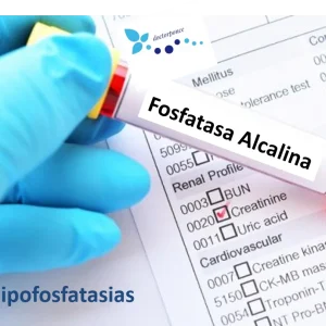 Fosfatasa Alcalina