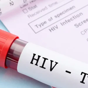 HIV