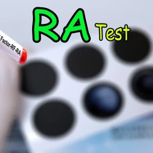 RA-TEST (Factor Reumático)