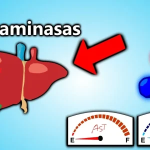 Transaminasas TGP o ALT