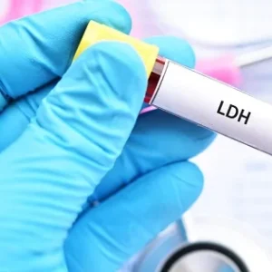 LDH (Lactato Deshidrogenasa)