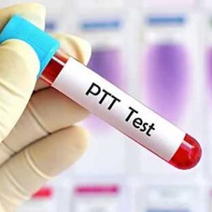 PTT (Tiempo de Tromboplastina Parcial)