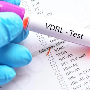 VDRL